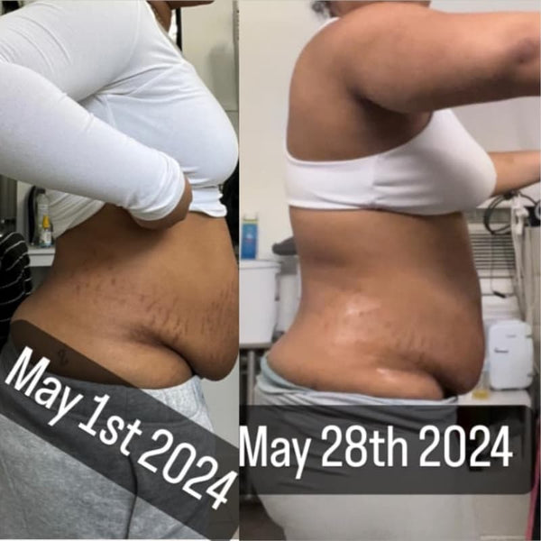 Before and after comparison